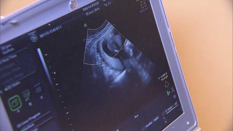 国内供卵卵源有哪些_代孕中心具体位置,试管婴儿低胎盘位置对妊娠影响浅析